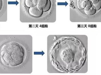 排卵障碍不容忽视，不孕大多是其原因！格尔木市哪家医院擅长排卵障碍试管方案？